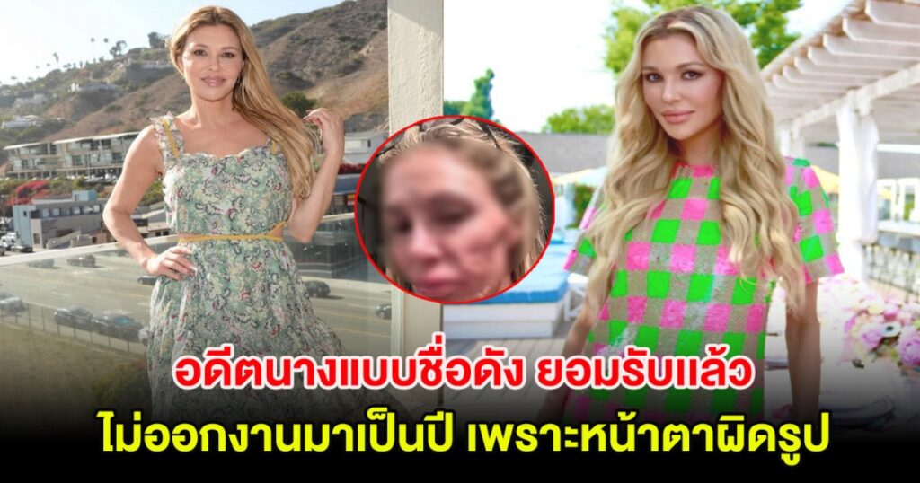 อดีตนางแบบชื่อดัง ยอมรับเเล้ว ไม่ออกงานมาเป็นปี เพราะหน้าตาผิดรูป (ต่างประเทศ)