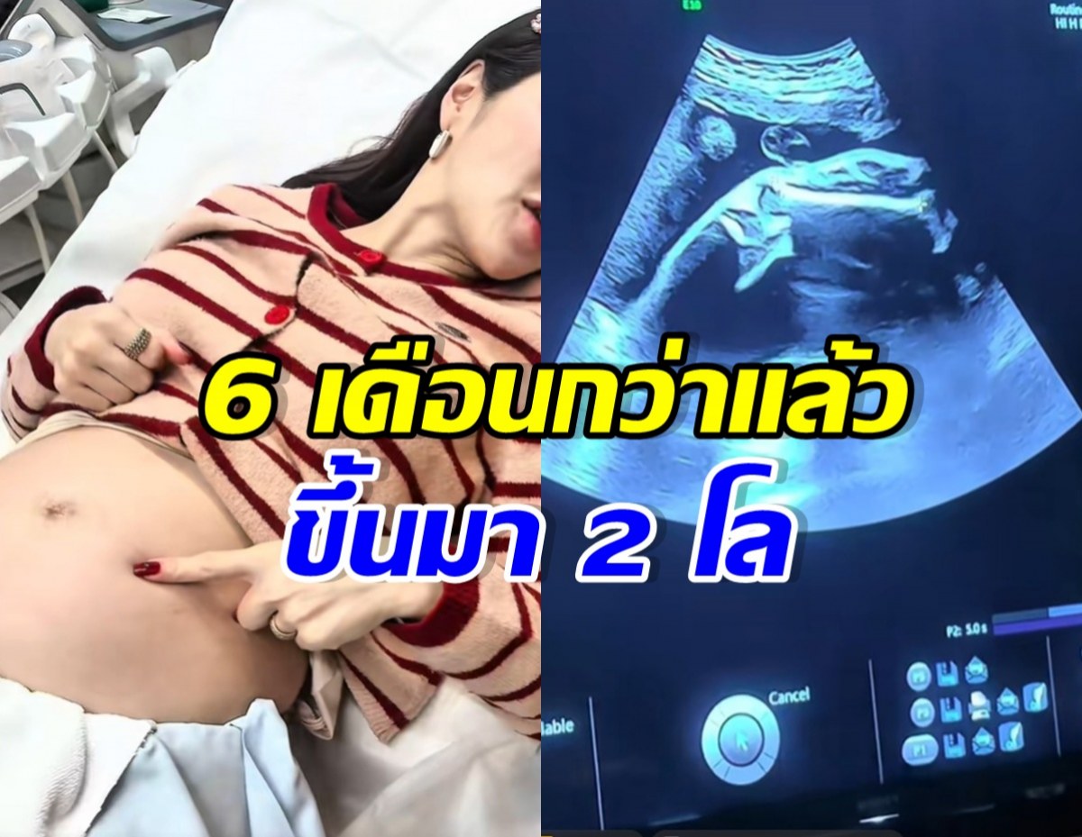 Collage of a pregnant woman in a hospital bed showing her belly on the left and an ultrasound scan of a fetus on the right; Thai overlay text reads '6 เดือนกว่าแล้ว' and 'ขึ้นมา 2 โล'