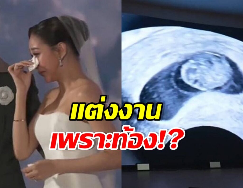 นุ่น เนตรชนก เปิดใจปมดราม่า ท้องก่อนแต่ง