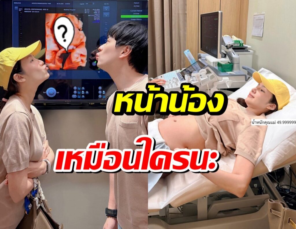 อาชิ อาชิตา อวดอัลตราซาวด์ เบบี๋หน้าเหมือนใคร?