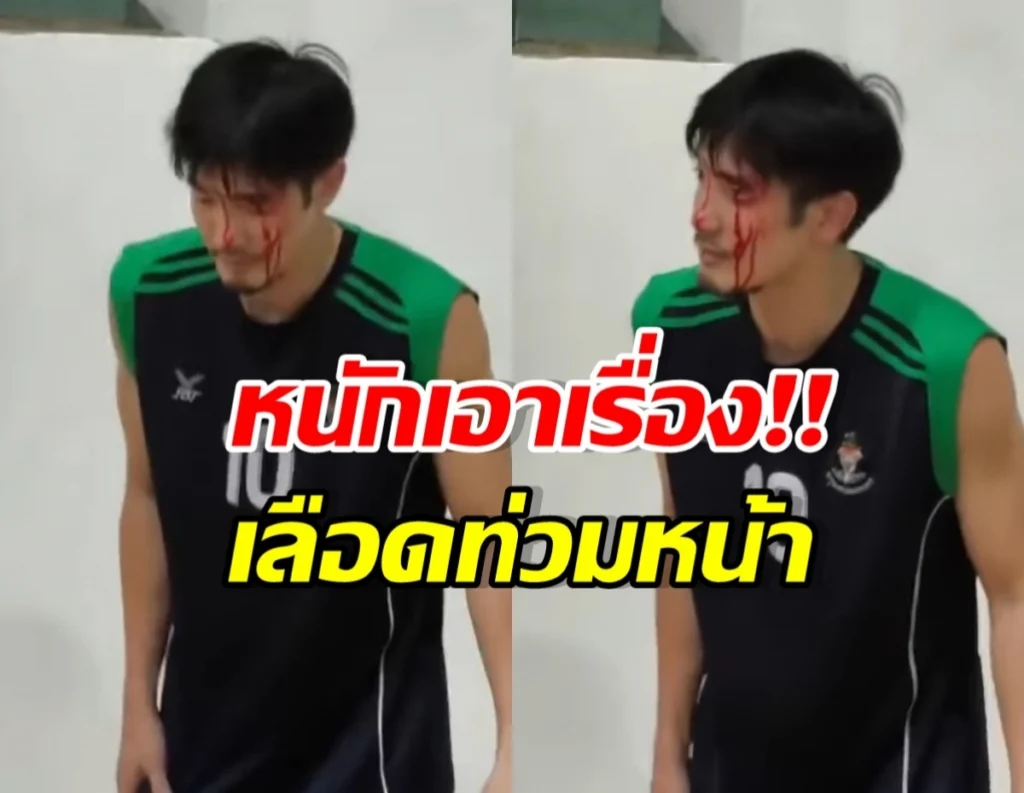 Video thumbnail: man with fake blood on his face, wearing a black and green sleeveless jersey, distressed expression, bold Thai captions overlaid.